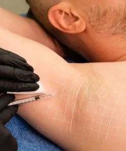 un client de la clinique niptuck en france paris effectuant Toxine Botulique