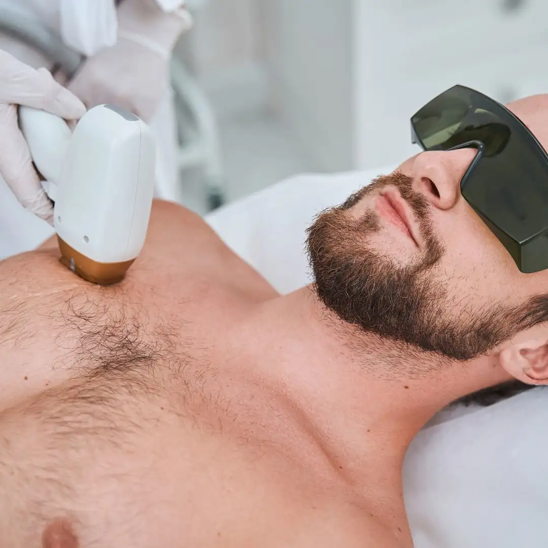 une image montrant un client allongé en train de pratiqué une sceance d'épilation laser au niveau du torse homme dans la clinique niptuck