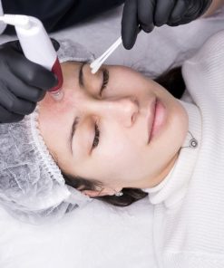 une cliente de la clinique niptuck en france paris effectuant une microneedling
